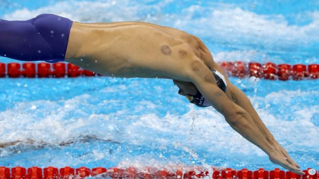 Olympic Cupping with Battle Balm®