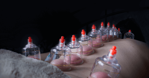Cupping therapy is a great way to move blood and lymph to the surface of the body.