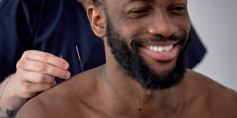 Male athlete getting acupuncture before Battle Balm all natural organic pain relief  cream treatment for shoulder injury.
